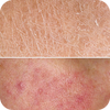 <h4>Skin Damage</h4>