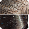 <h4>Scalp Issues</h4>